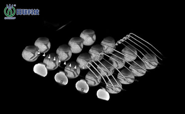 自動(dòng)X射線(xiàn)檢查技術(shù)